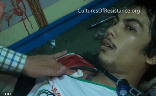 Suria, seorang relawan dari Indonesia dalam keadaan cemas akibat tembakan di sebelah kanan dadanya.